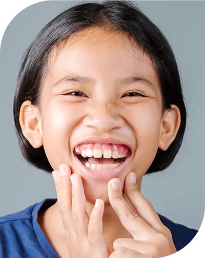 A Child Laughing With Bad Teeth
