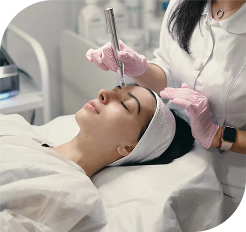 Girl Going Through Microneedling Face Treatment