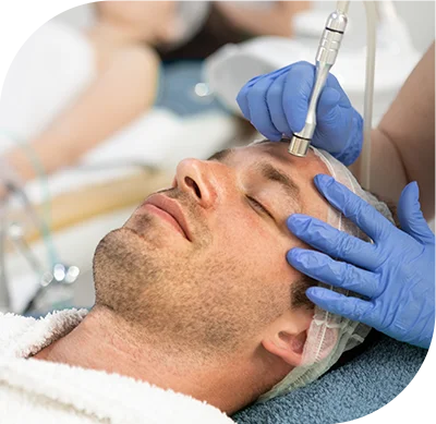 Man Going Through Microneedling Face Treatment