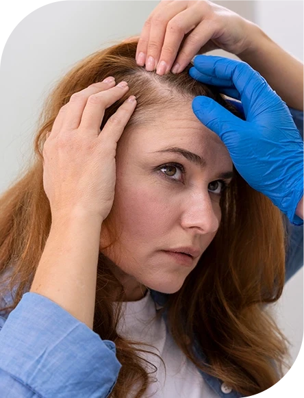 Woman Is Thinking To Take Microneedling PEP Hairs Treatment